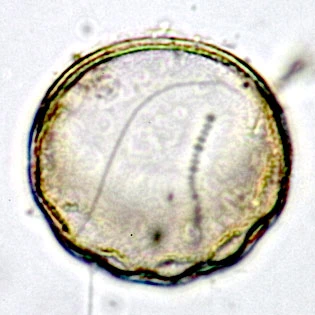 Pyxidicula patens var.