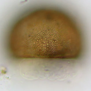 Pyxidicula patens var.