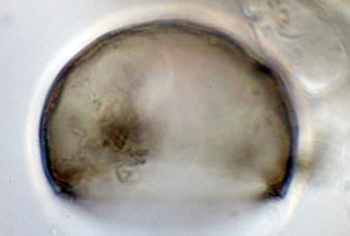 Pyxidicula spec.