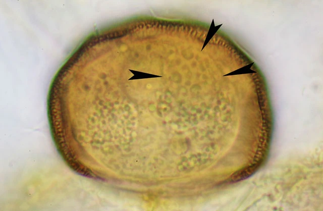 Pyxidicula spec.