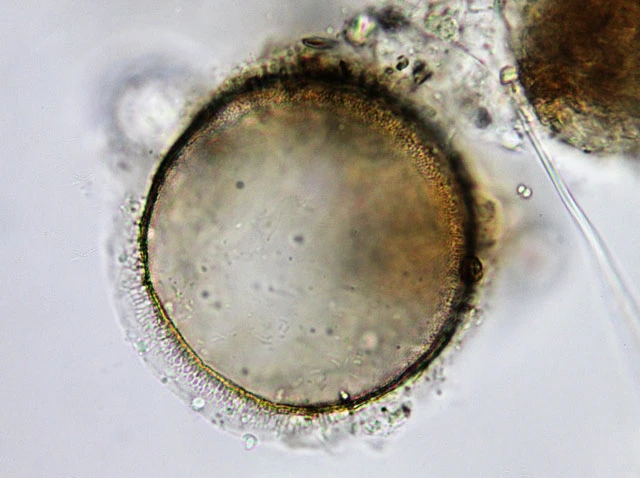 Pyxidicula cymbalum