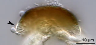 Pyxidicula invisitata