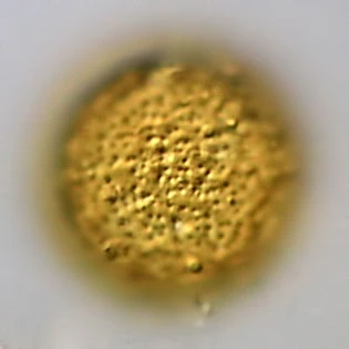 Pyxidicula invisitata