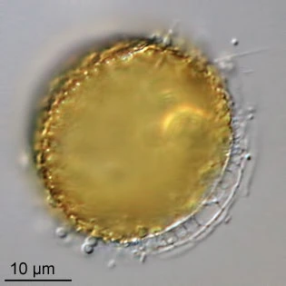 Pyxidicula invisitata