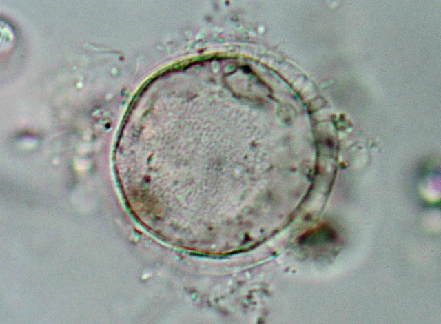Pyxidicula invisitata