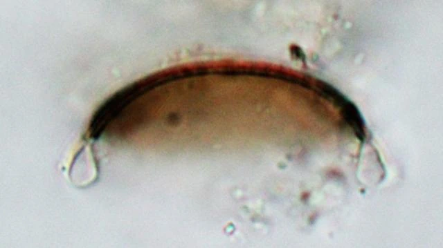 Pyxidicula invisitata