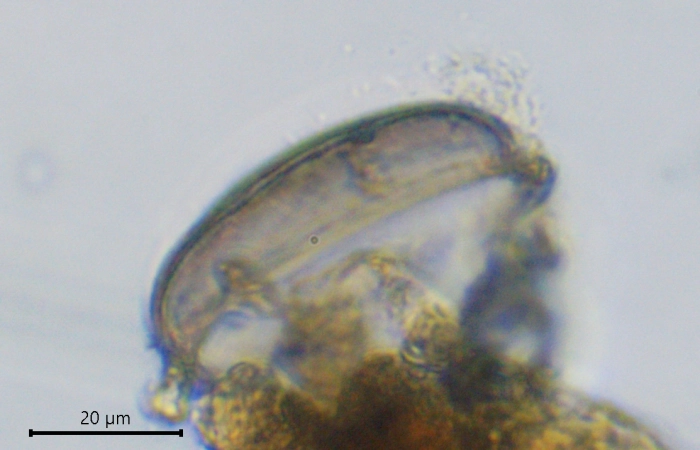 Pyxidicula Mongolia
