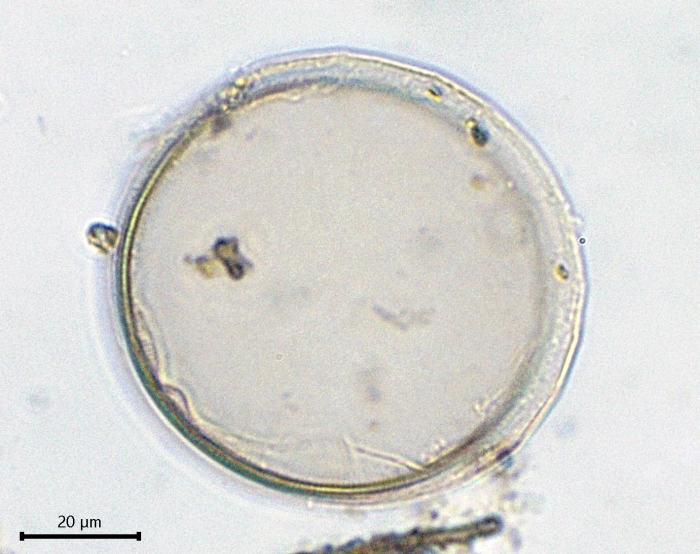 Pyxidicula Mongolia