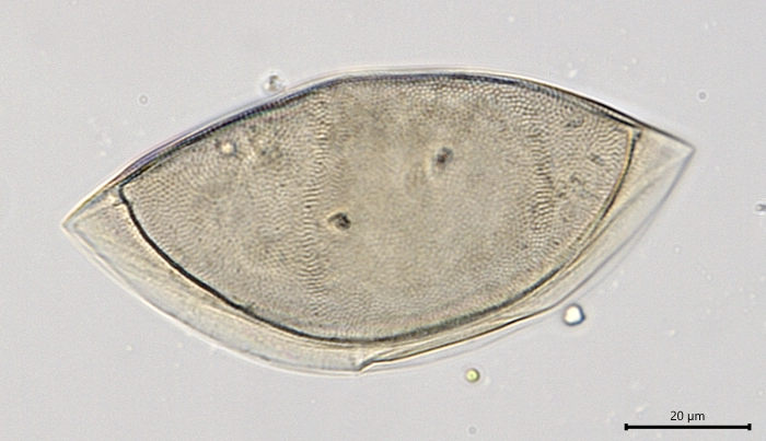 Pyxidicula Mongolia