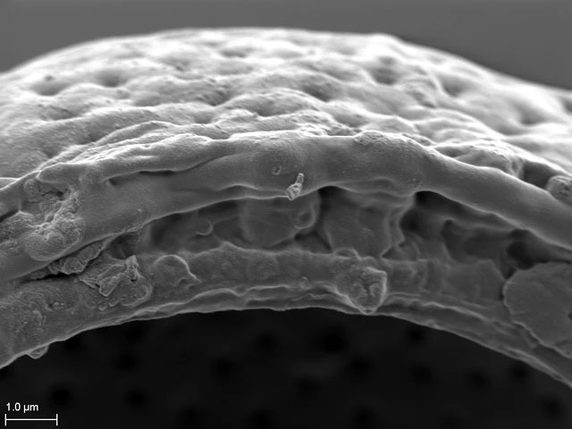 Pyxidicula patens var.