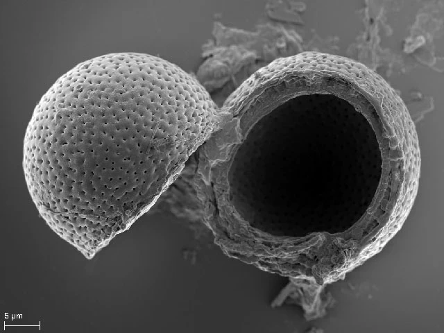 Pyxidicula patens var.