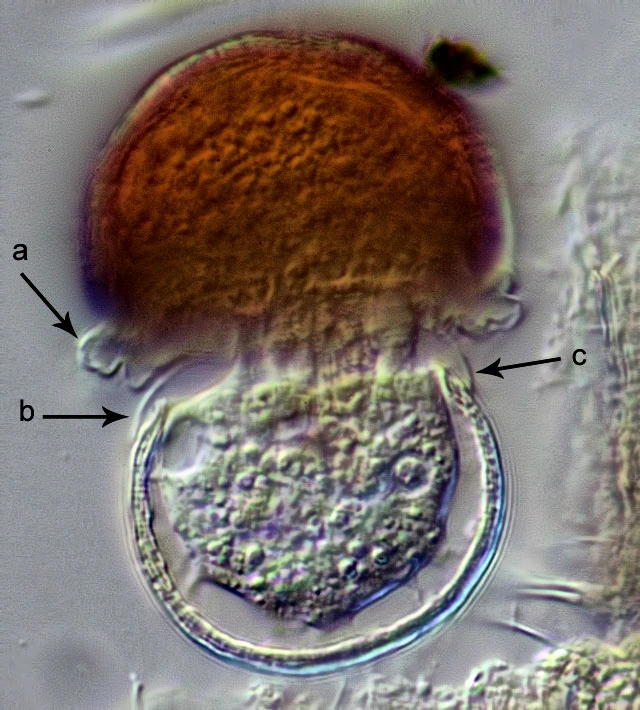 Pyxidicula spec.