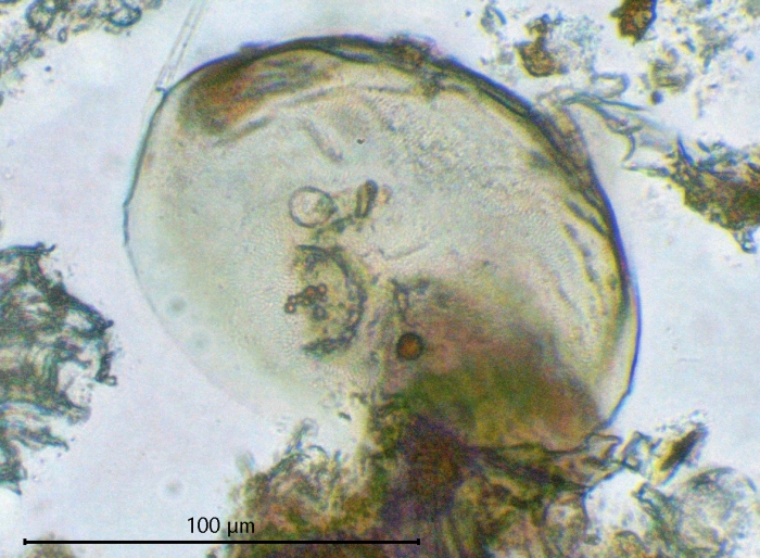 Pyxidicula