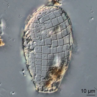 Quadrulella quadrigera