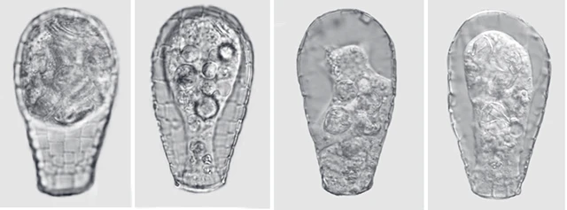 Quadrulella variabilis