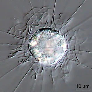 Raphidiophrys elegans