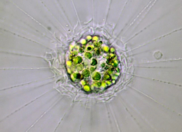 Raphidiophrys elegans