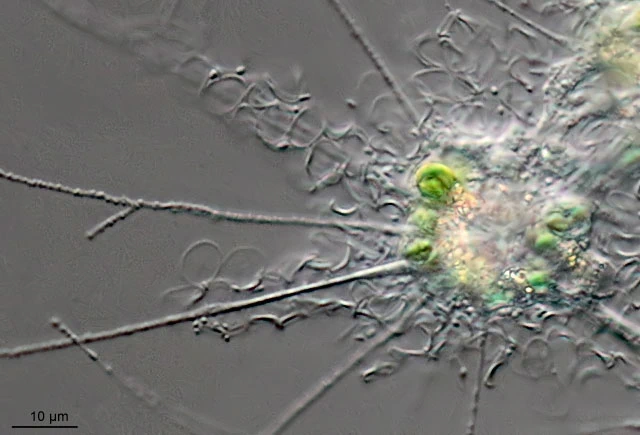 Raphidiophrys elegans