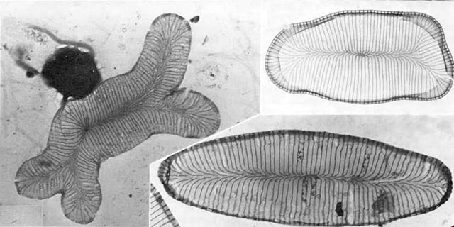 Raphidiophrys elegans