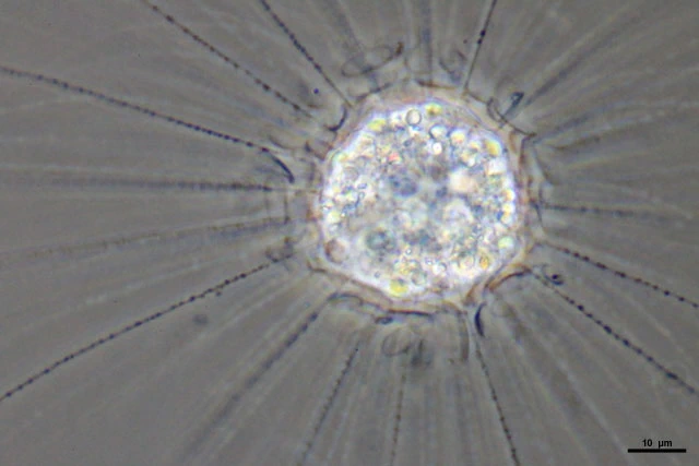 Raphidiophrys elegans