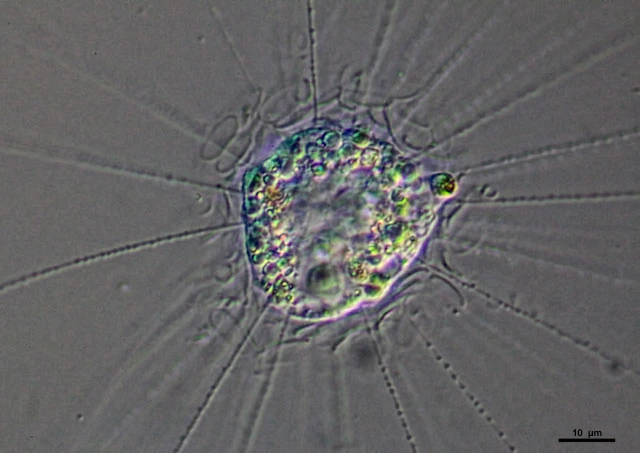 Raphidiophrys elegans