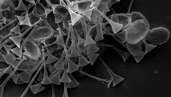 Raphidocystis glabra