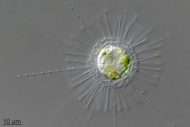 Raphidiocystis tubifera