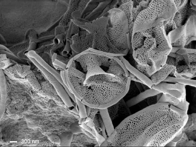 Raphidocystis tubifera