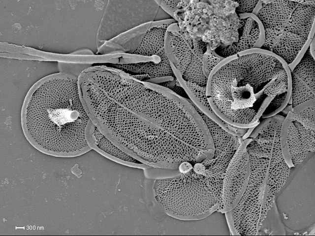 Raphidocystis tubifera