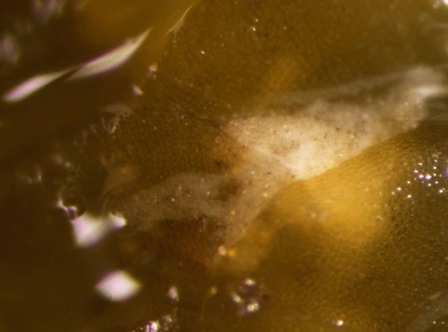 Reticulomyxa filosa