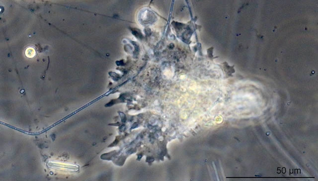 Rhizamoeba clavarioides