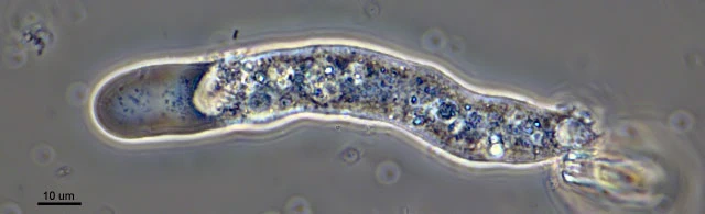Rhizamoeba clavarioides