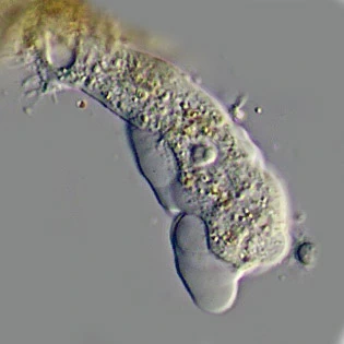 Rhizamoeba clavarioides
