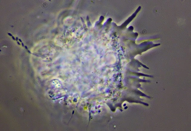 Rhizamoeba timidum