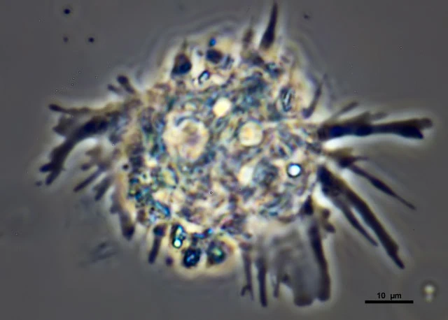 Rhizamoeba timidum
