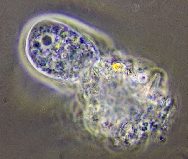 Rhizamoeba timidum