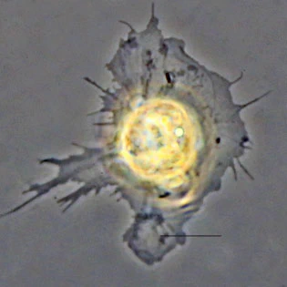 Rhogostoma
