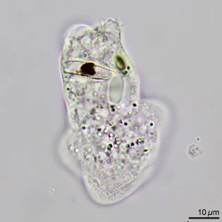 Saccamoeba stagnicola