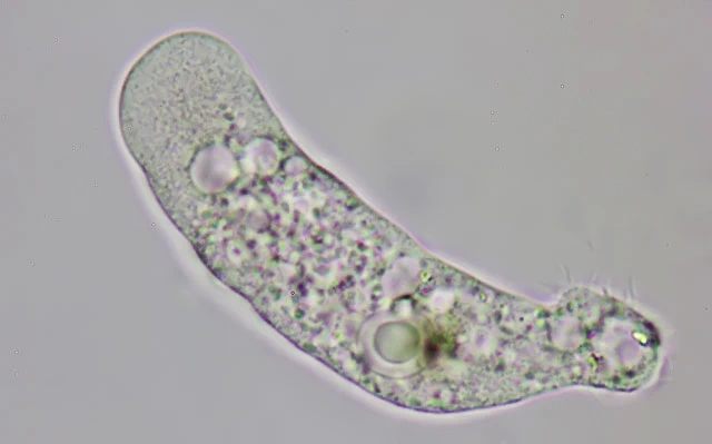 Saccamoeba stagnicola