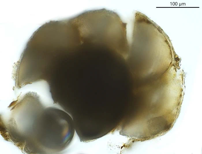 Unknown freshwater foraminifer