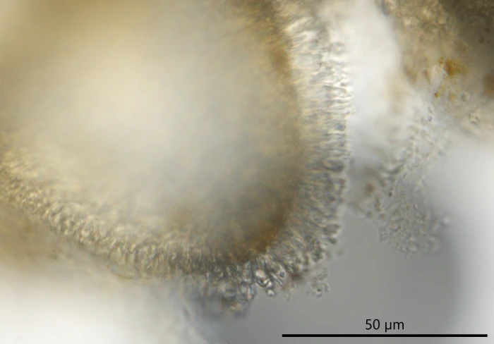 Unknown freshwater foraminifer
