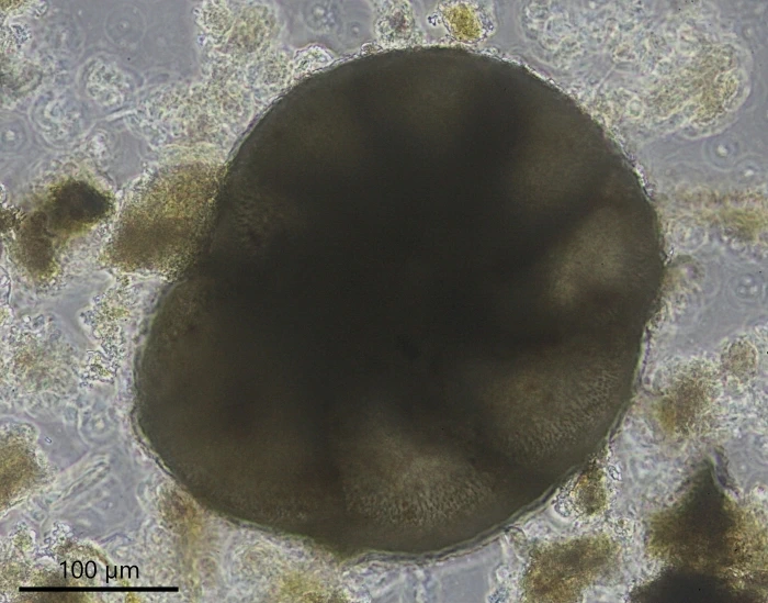 Unknown freshwater foraminifer