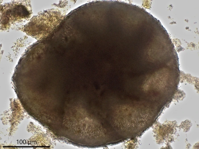 Unknown freshwater foraminifer