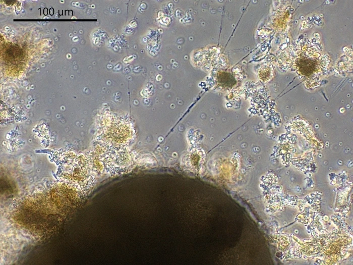 Unknown freshwater foraminifer