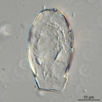 Sphenoderia fissirostris