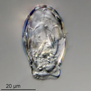 Sphenoderia fissirostris