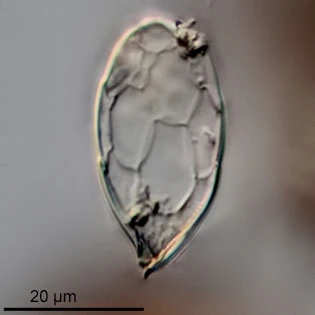 Sphenoderia fissirostris