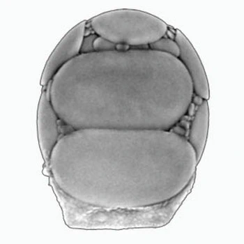 Sphenoderia