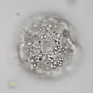 Spumochlamys illiensis