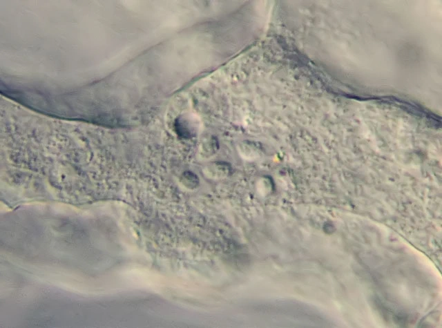 Thecochaos fibrillosum